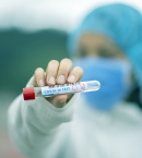 Ministerstvo obrany zverejnilo, ako bude vyzerať celoplošné testovanie