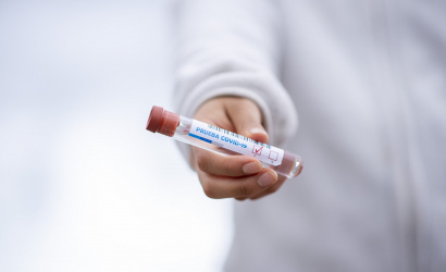 Štátny ústav zaregistroval slovenský test na nový koronavírus