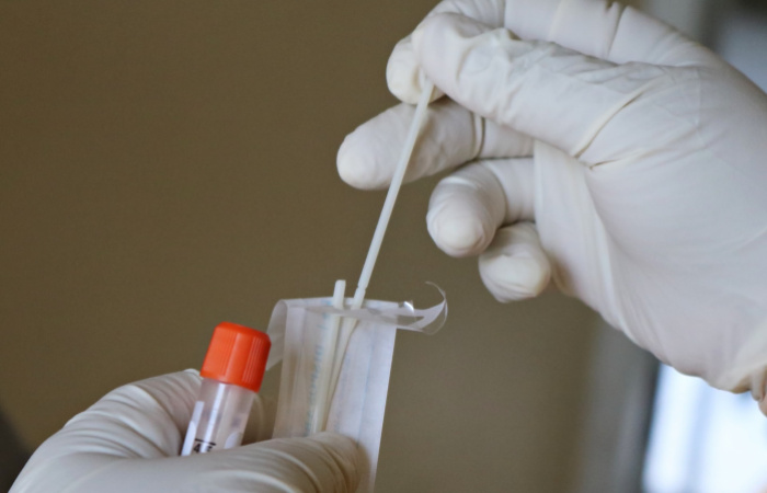Máte príznaky Covidu-19? PCR test máte zadarmo, pripomína štát.